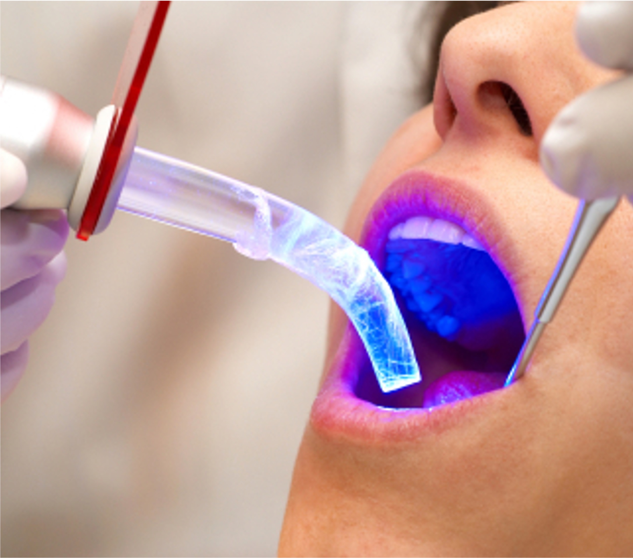Oral Fluorescents